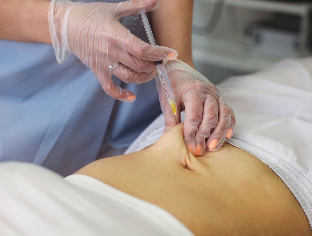 LS Aesthetic Body Contouring & Slimming Treatments