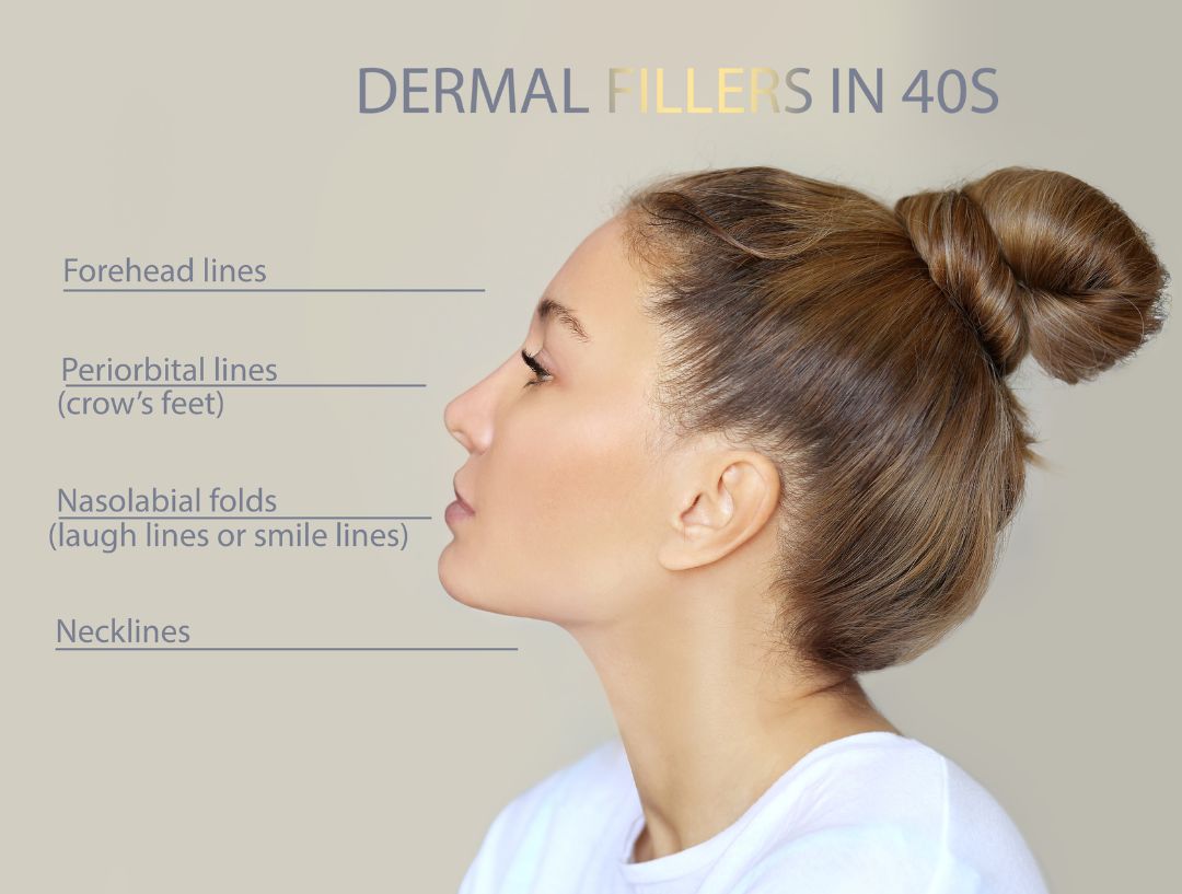 Dermal Fillers Malaysia